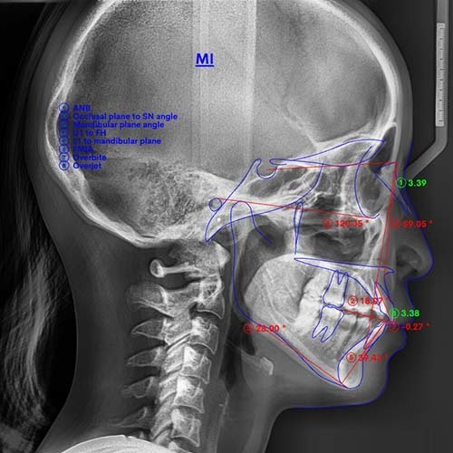 当院が導入する歯科用CT