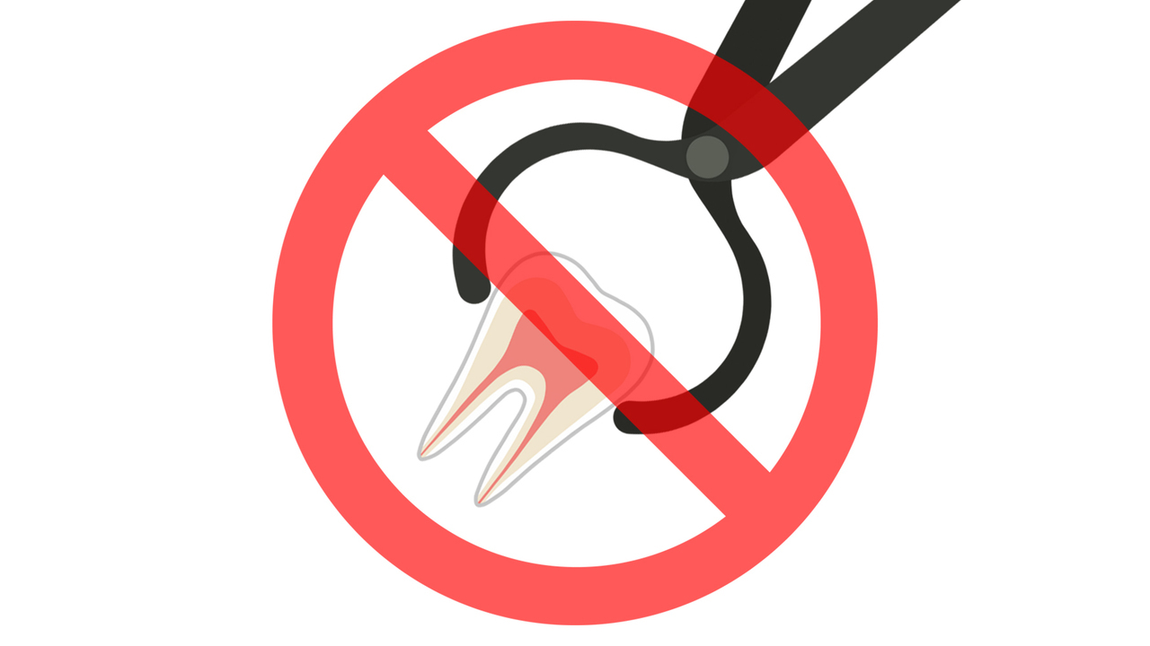 非抜歯矯正に関する案内ページへのリンク