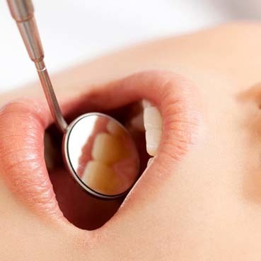 歯科矯正の経過観察中に口腔内チェックを受ける様子