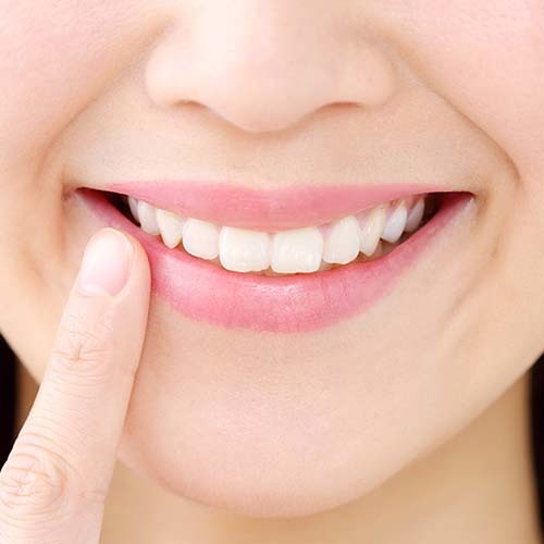 保定期間中に使用するリテーナー