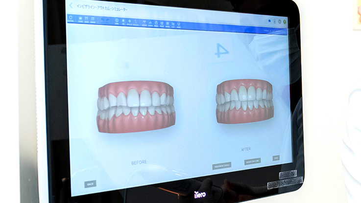 専門知識と豊富な経験に基づいて作られた治療計画