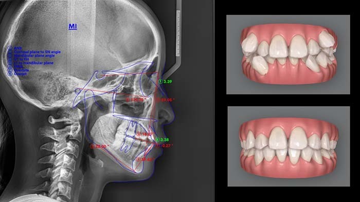 骨格や歯の状態の分析に使う精密検査画像のイメージ
