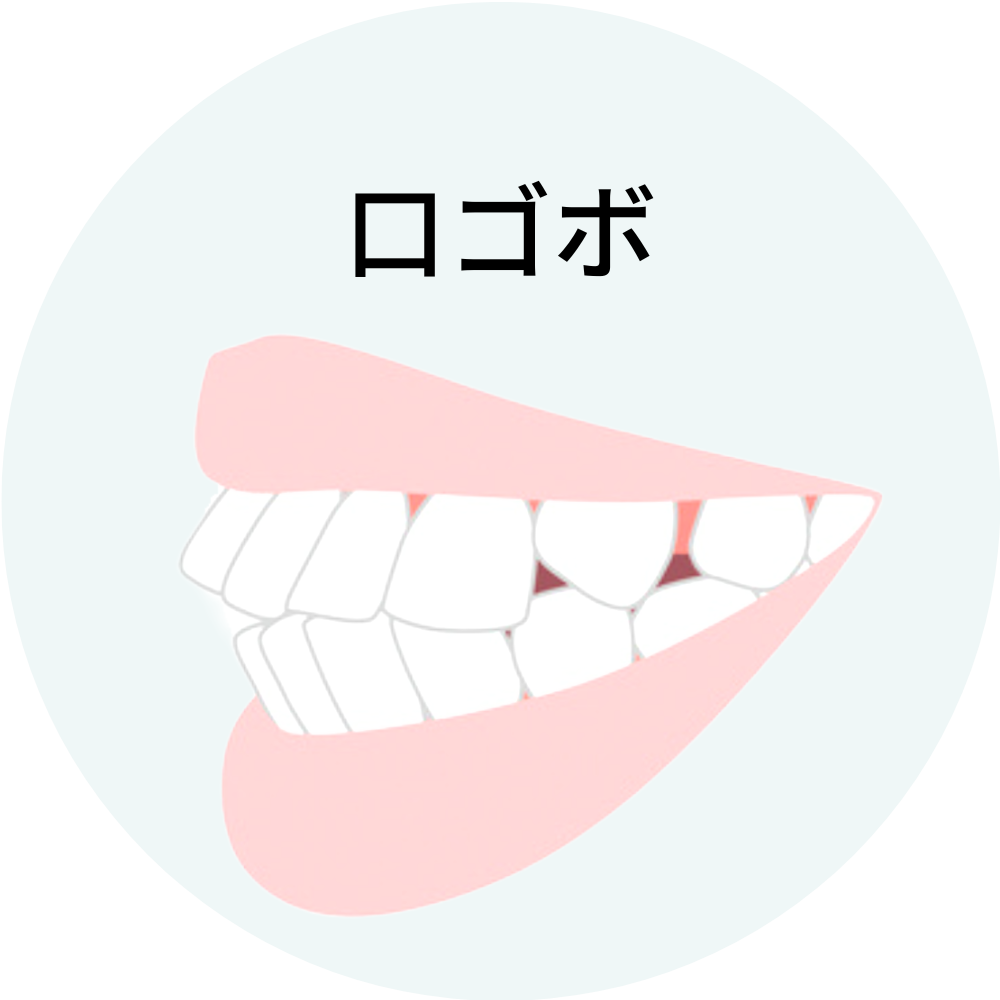 福岡県福岡市博多の口ゴボの矯正治療