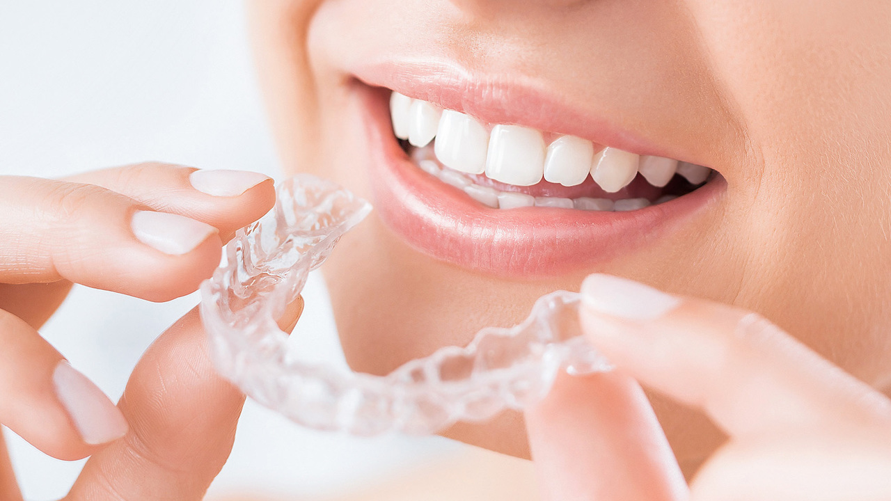 マウスピース矯正装置を装着し、治療を始める患者