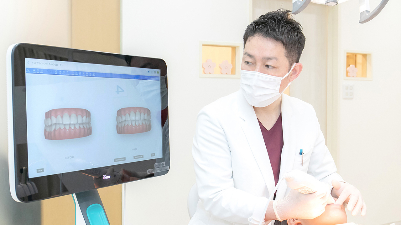 iTeroを使ったシミュレーションのイメージ画像